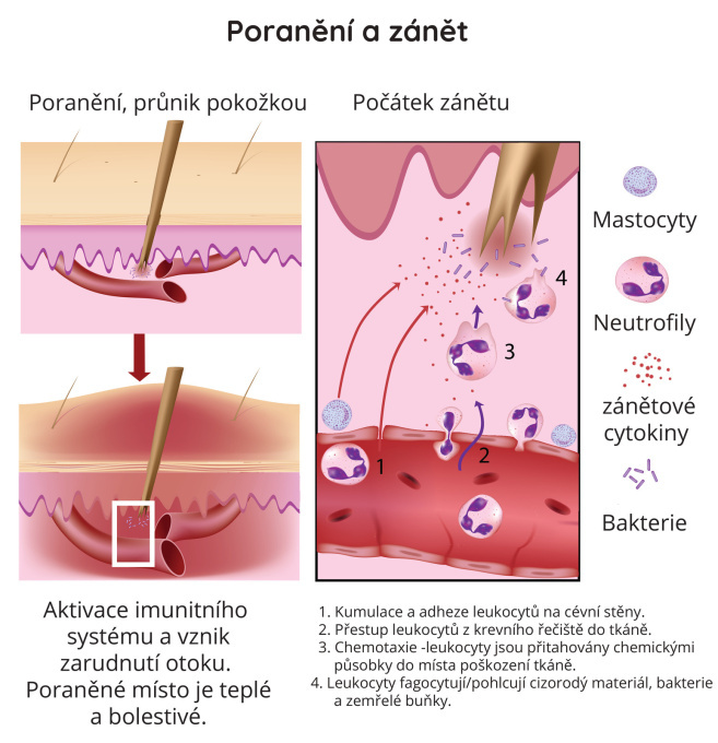 Poranění a zánět