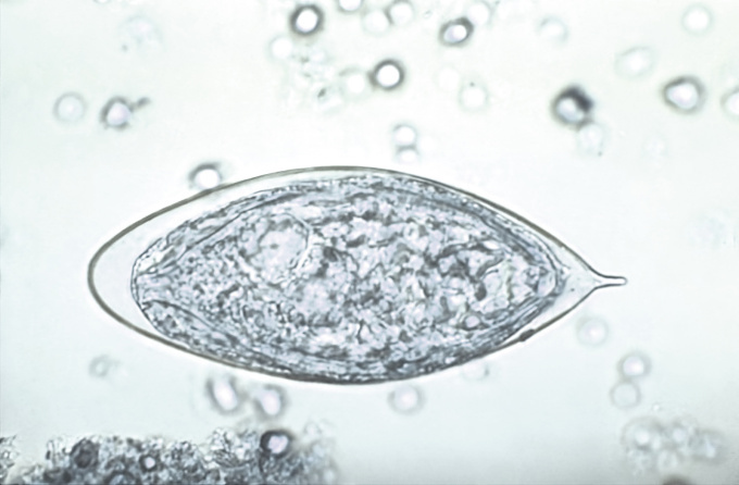 Krevnička močová (Schistosoma haematobium)