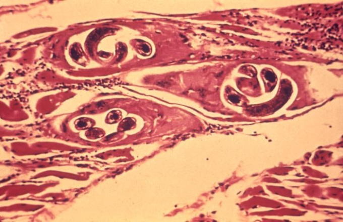 Svalovec stočený (Trichinella spiralis Owen)