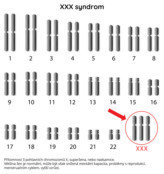 XXX syndrom