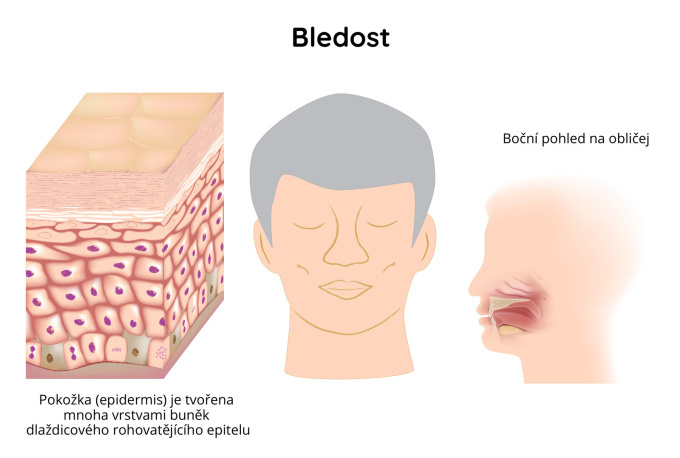 bledost v obličeji