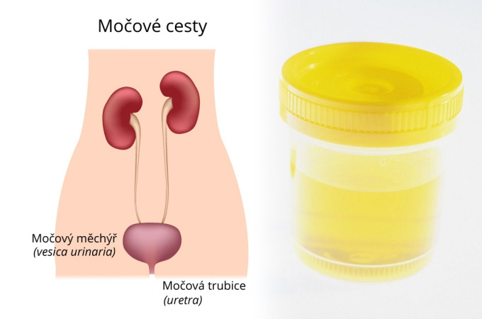 Krev v moči