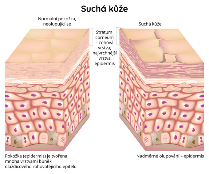 Suchá pokožka, nadměrné olulpování