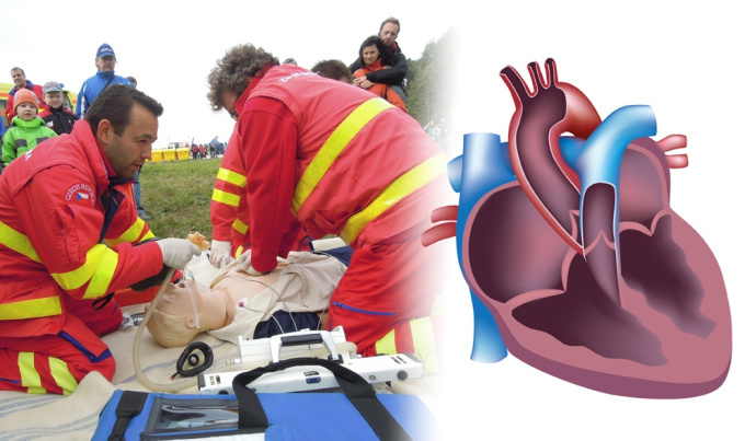 Resuscitace