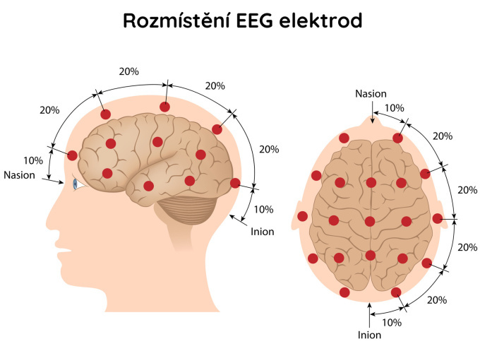 Umístění elektrod při vyšetření EEG
