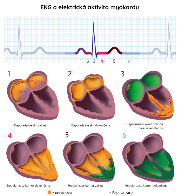 Záznam EKG - elektrické aktivity srdečního svalu