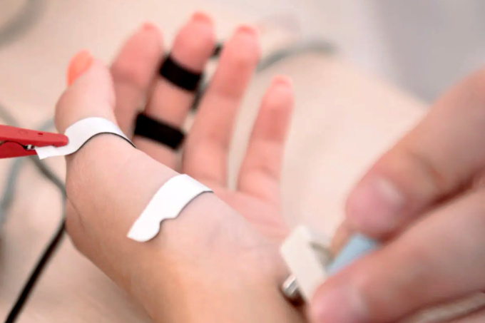 Elektromyografie (EMG) 