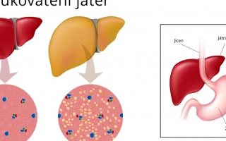 Zvětšení jater