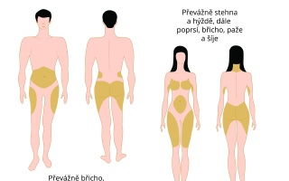 Rozdíly v rozložení podkožního tuku u mužů a žen