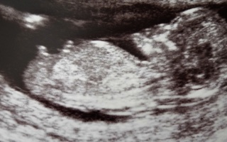 Třetí měsíc těhotenství
