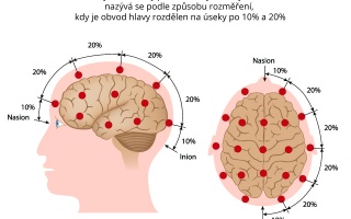 EEG