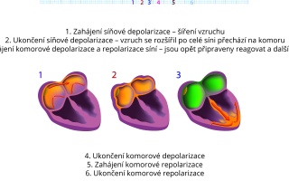 EKG záznam