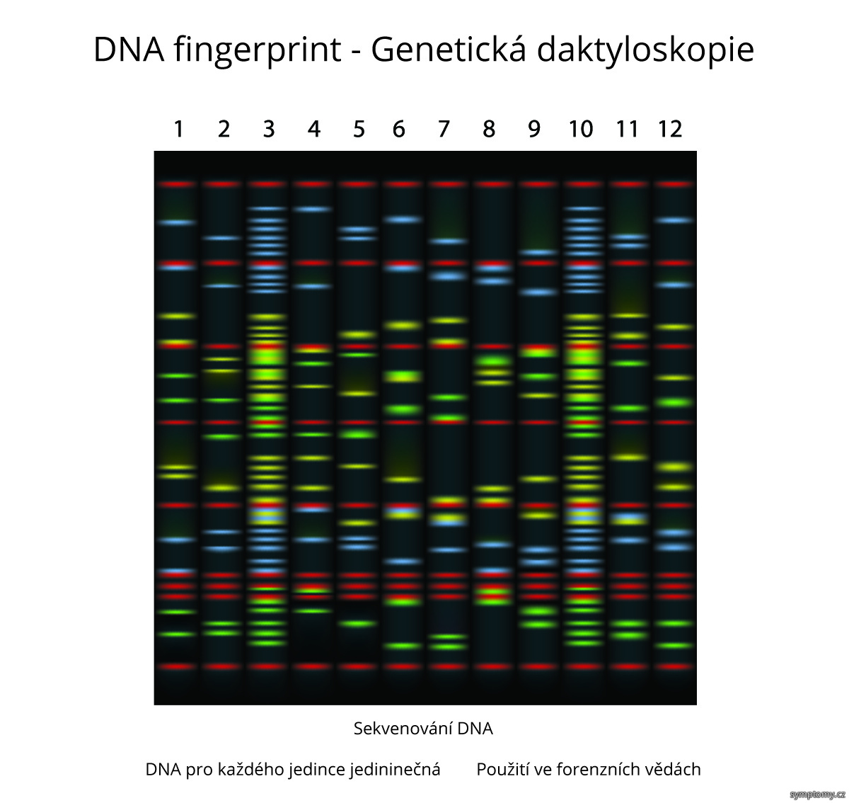 DNA fingerprint - Genetická daktyloskopie