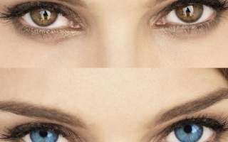 Laserová operace pro změnu barvy očí