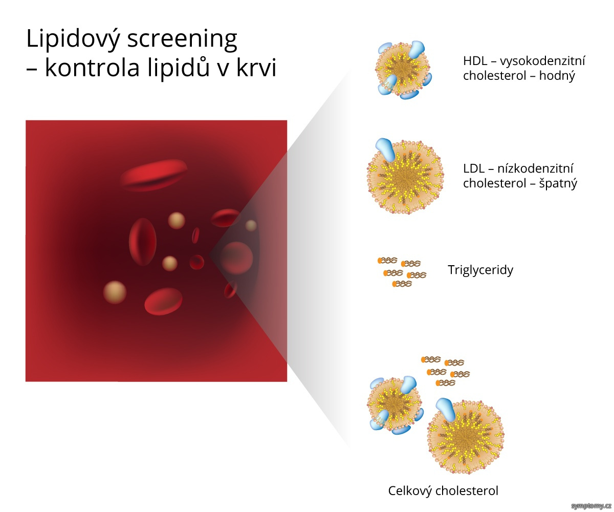 Lipidový screening - kontrola lipidů v krvi