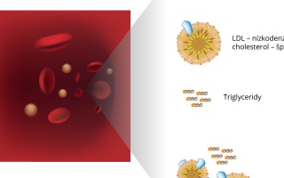 Lipidový screening